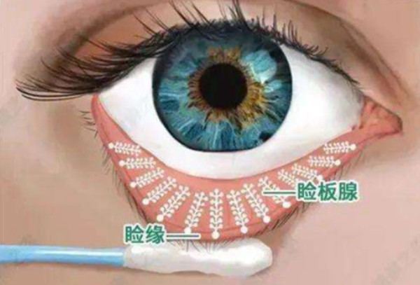  2025最新！衢州爱尔眼科预约流程详解：微信/官网都能约，周末号源紧张