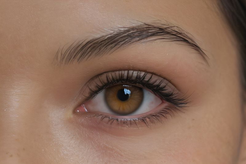 一、王晓瑛医生ICL手术的资质与技术优势www.sanjiaojingti.com