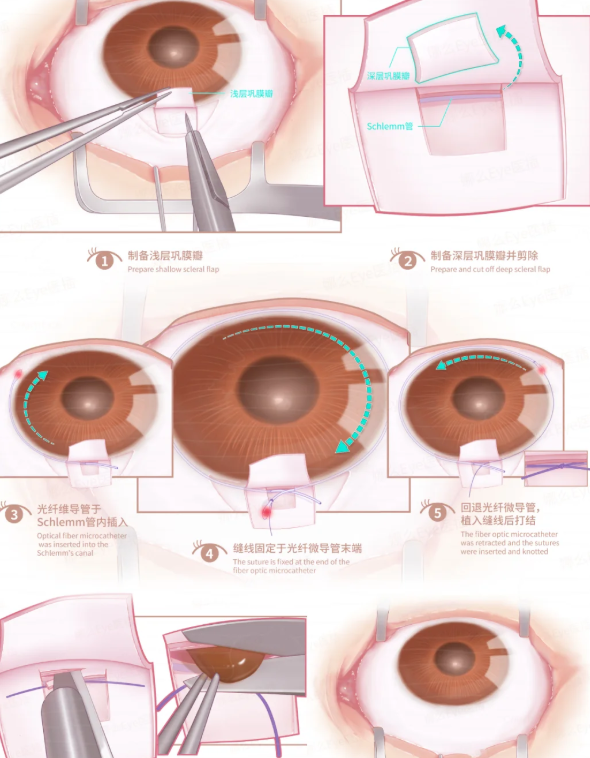 横州爱尔眼科较值得去的3个科室