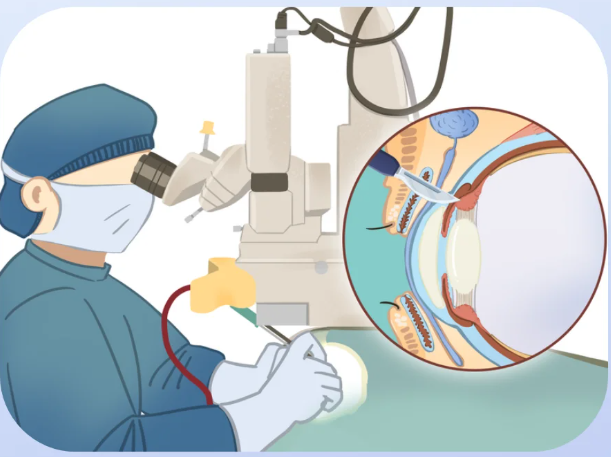 北京华德眼科医院张舒心出诊时间全攻略