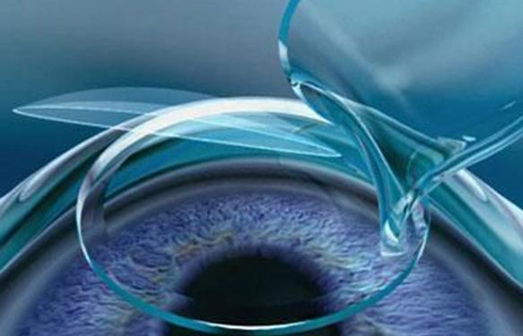 蔡磊琳眼科医生国内排名第几？扒完5年执业数据，这个名次实至名归