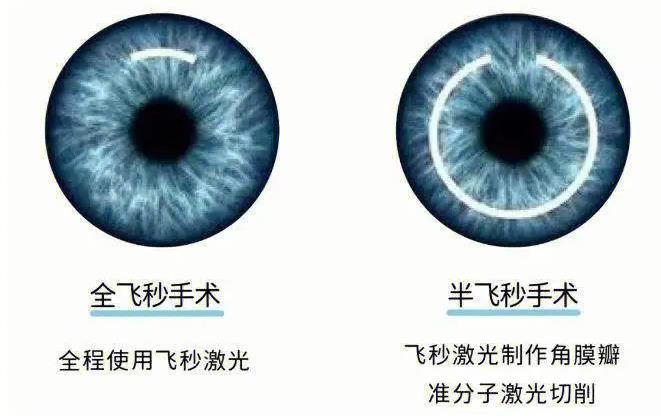 一、内蒙古朝聚眼科医院预约挂号真实流程