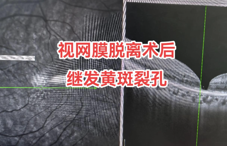 赵培泉眼科全国排第几