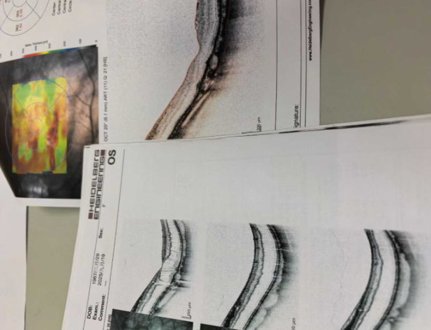 赵培泉眼科服务与流程