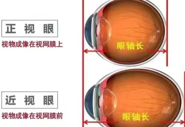 四、宜春爱尔眼科医院价格透明度:无隐形消费,术后服务完善