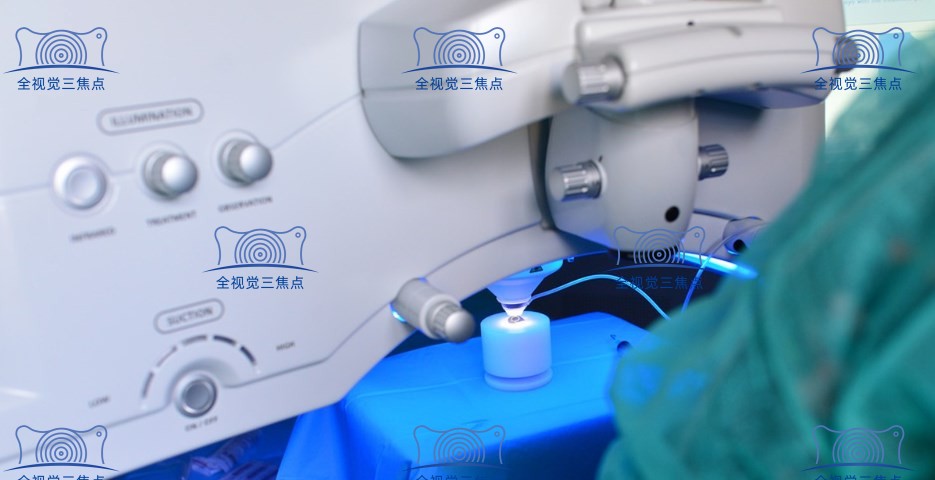 全飞秒激光近视手术起源于西方