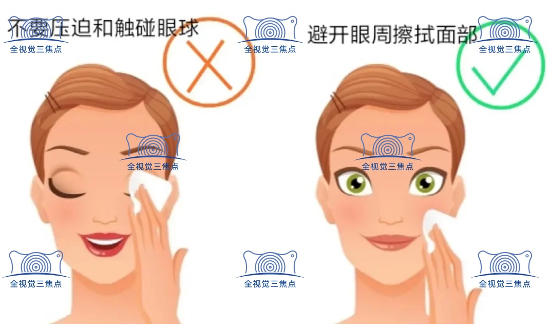 近视眼手术后多久能洗脸