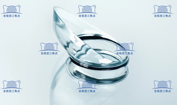 角膜塑形镜示意图3