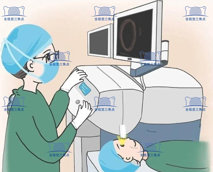 飞秒近视手术卡通图www.sanjiaojingti.com