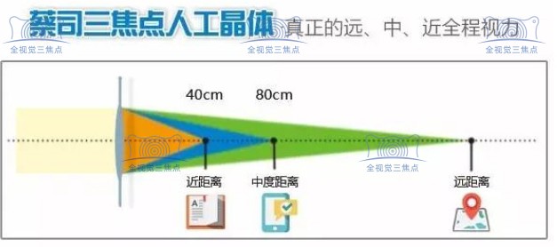 蔡司三焦点晶体优势