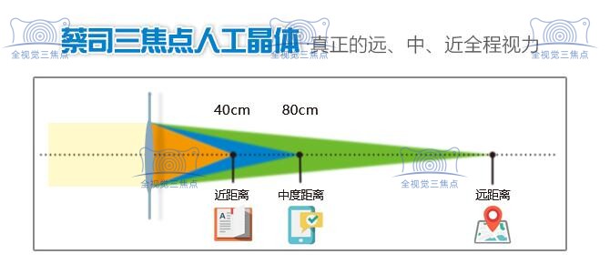 蔡司三焦点晶体植入可解决远中近视力问题