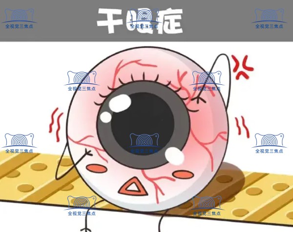 干眼症也不可以做半飞秒激光手术sanjiaojingti.com