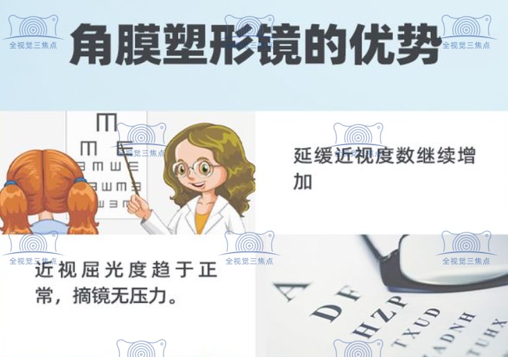 欧几里德角膜塑形镜使用年限www.sanjiaojingti.com