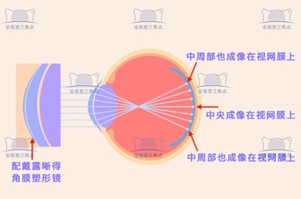 ok镜的原理www.sanjiaojingti.com