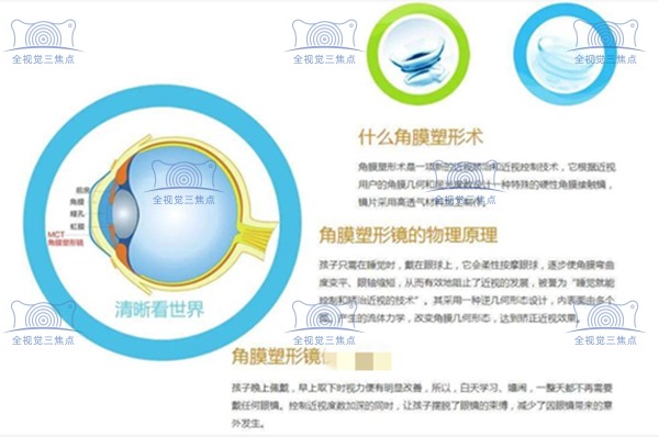 角膜塑形镜的原理