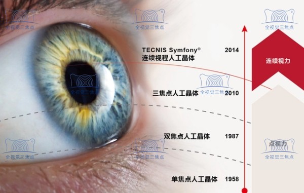 做白内障手术用的人工晶体有几种类型