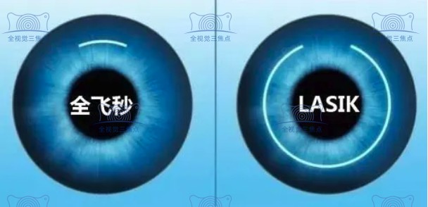 全飞秒和半飞秒激光矫正选谁好