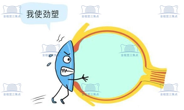 戴8年角膜塑形镜的体会和感受：非常满意