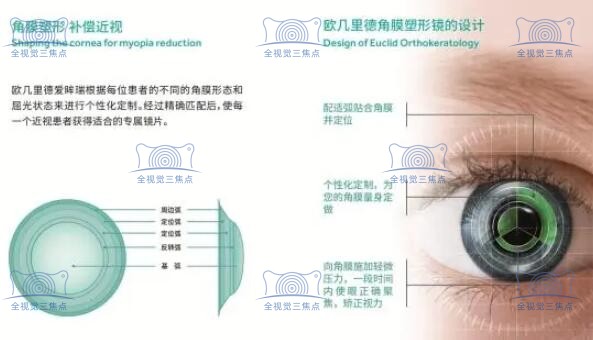 欧几里德ok镜的寿命一般能戴多久