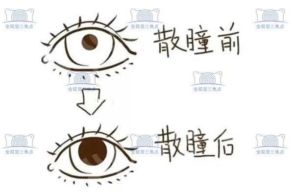 散瞳前后的对比