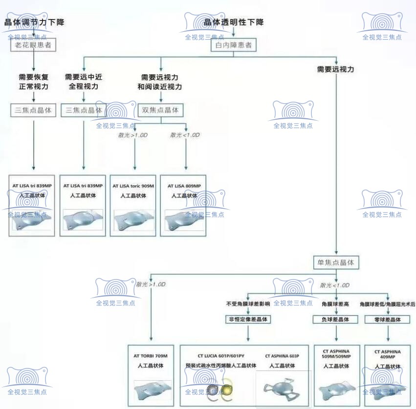 德国蔡司晶体治疗白内障疗效好