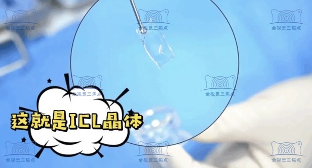 icl太贵应不应该做三焦晶体