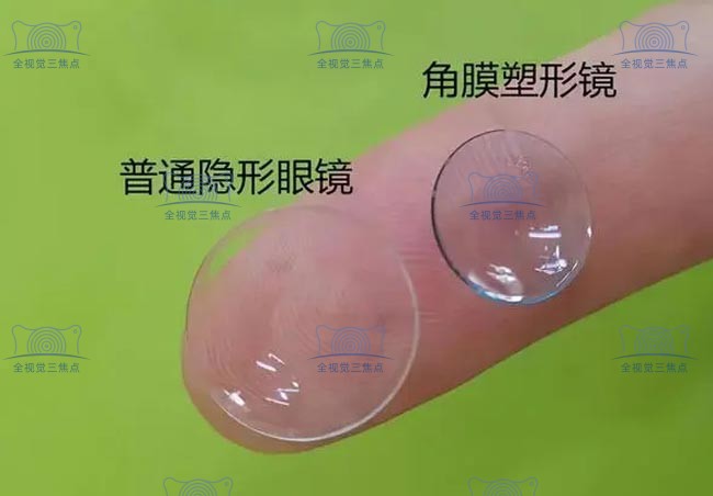 进口角膜塑形镜排名前十