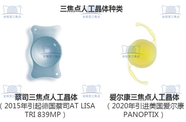 白内障人工三焦晶体的优点sanjiaojingti.com