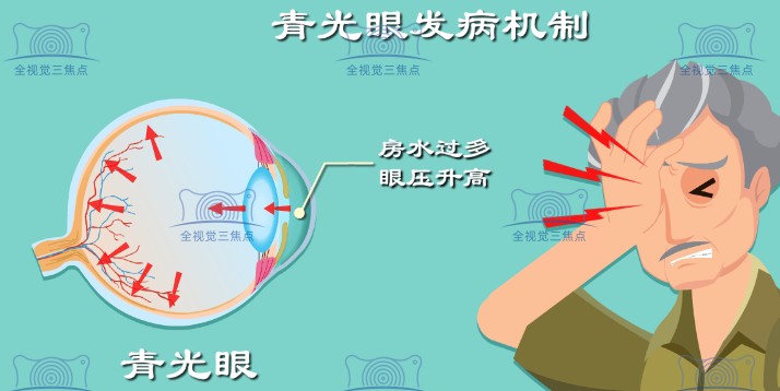 减少对手机依赖，过度玩手机会增加青光眼发生概率