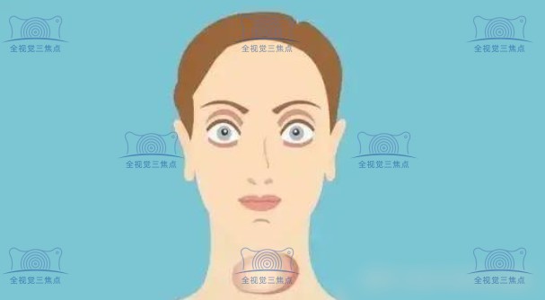 凸眼矫正