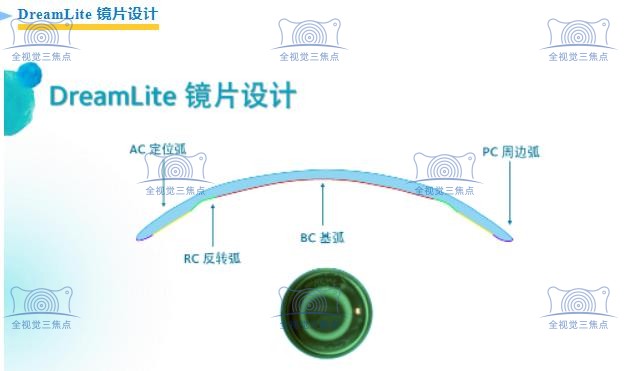 荷兰dreamlite梦享角膜塑形镜怎么样