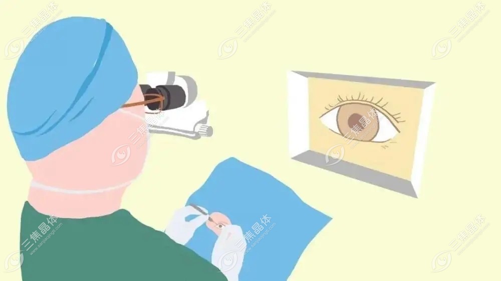 虹膜夹持型人工晶体矫正高度近视稳定性高
