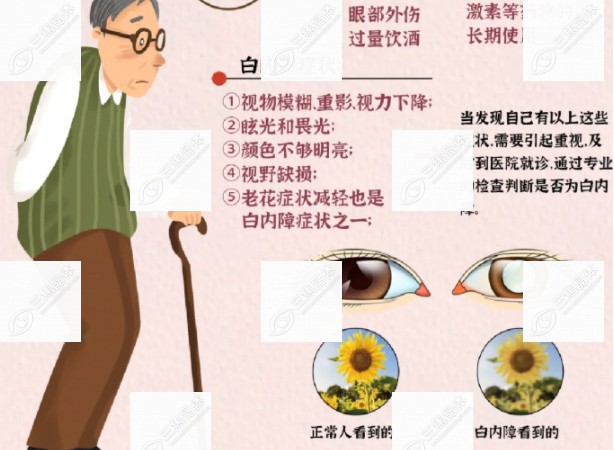 白内障手术3年后又变模糊www.sanjiaojingti.com