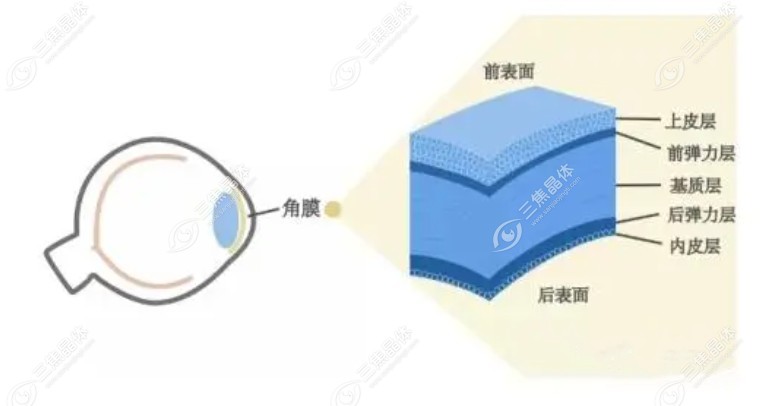 角膜厚度多少可以做飞秒手术