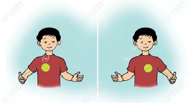 散光可以通过训练改善吗