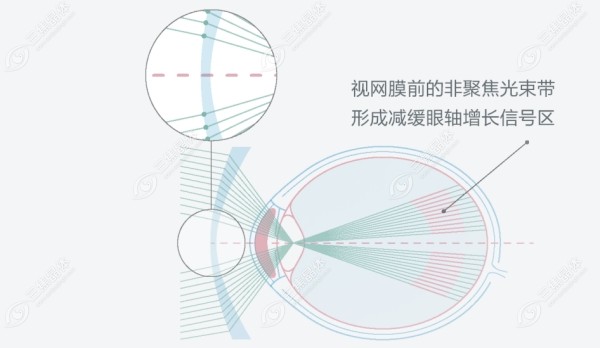 依视路星趣控镜片的价格