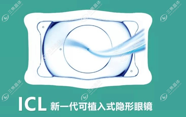 普瑞近视ICL晶体植入手术价格27800元起