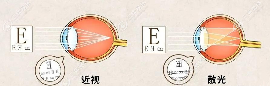 眼镜店缺乏定制能力