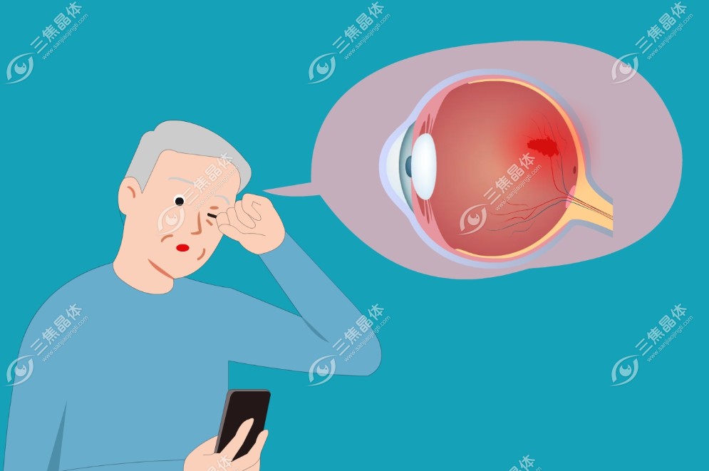 普瑞眼科白内障晶体植入手术价格表