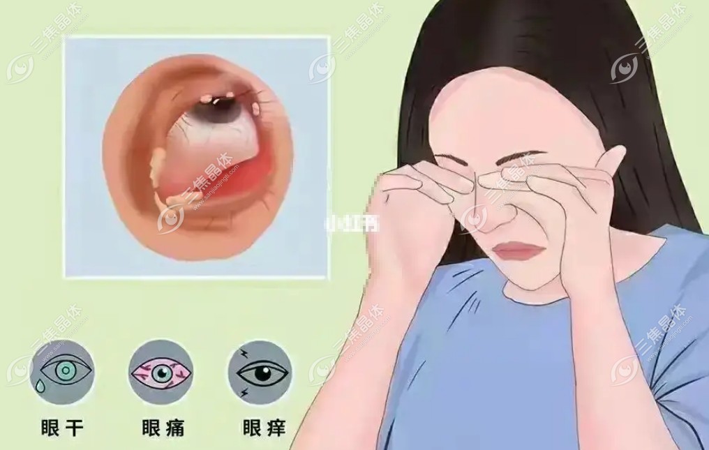 眼睛干涩发痒和肝脏有关系吗?可能有