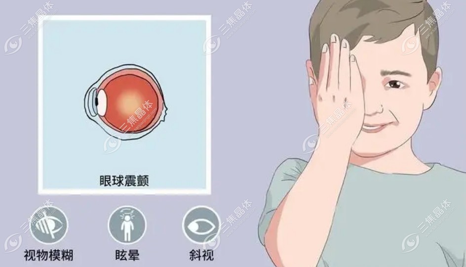 眼球震颤可以做晶体植入近视手术吗?可以