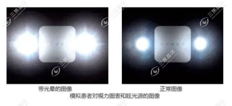 眼睛眩光看东西的样子