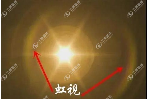 生理性虹视和病理性虹视的区别~三焦晶体