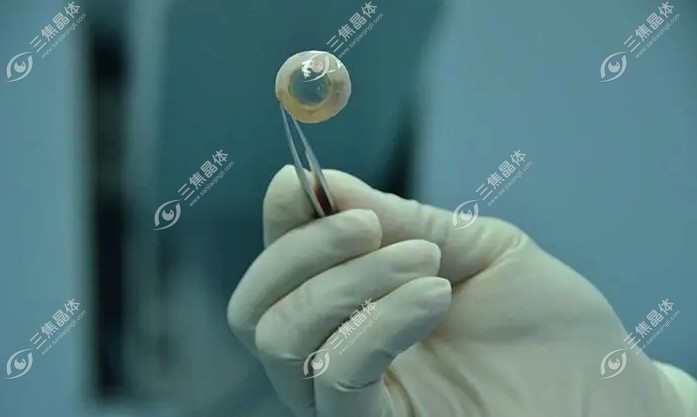 角膜移植供体一般等待多长时间www.sanjiaojingti.com