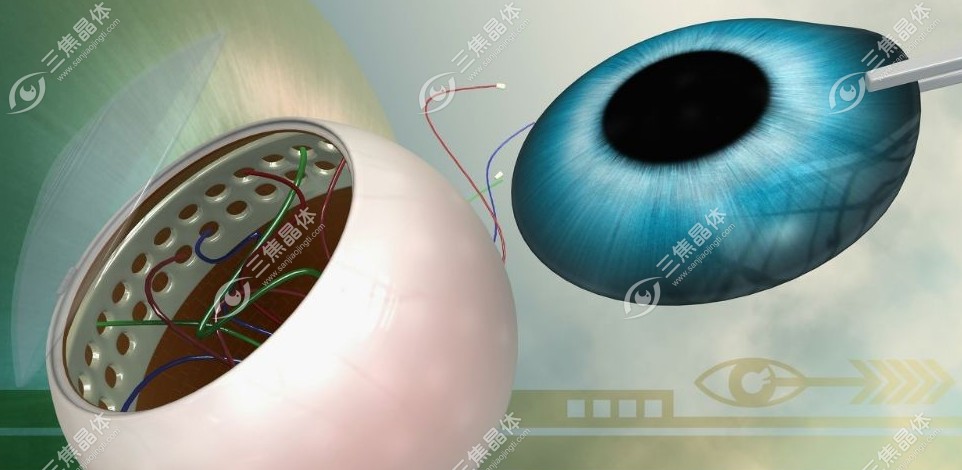 角膜移植手术可以报销吗