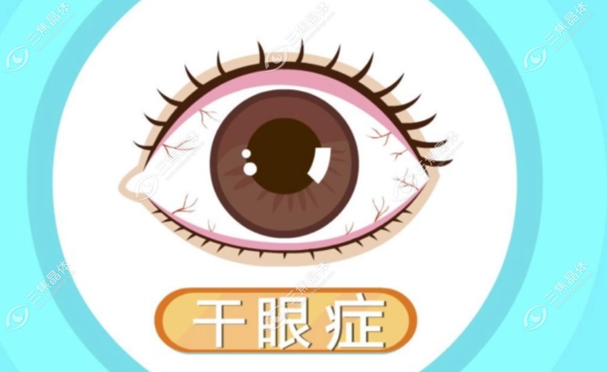 睑板腺功能缺失的干眼症能做晶体植入手术