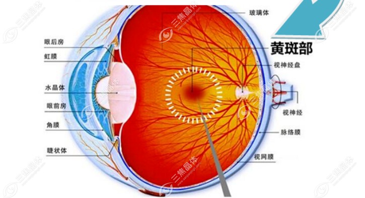 眼底黄斑前膜是否需要手术治疗取决于病情程度、症状和影响程度