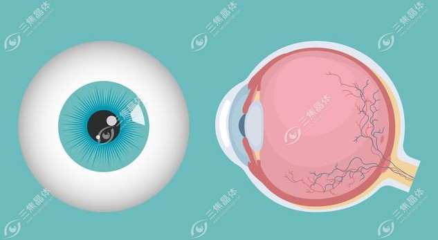白内障人工晶体植入手术也是分一期手术、二期手术的www.sanjiaojingti.com