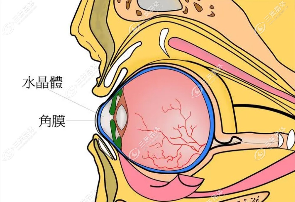 角膜内皮细胞形态异常不可以做白内障手术