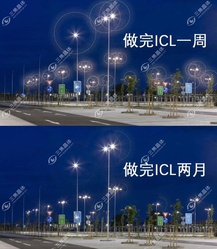 麦迪格眼科医院做icl晶体植入手术好@三焦晶体网